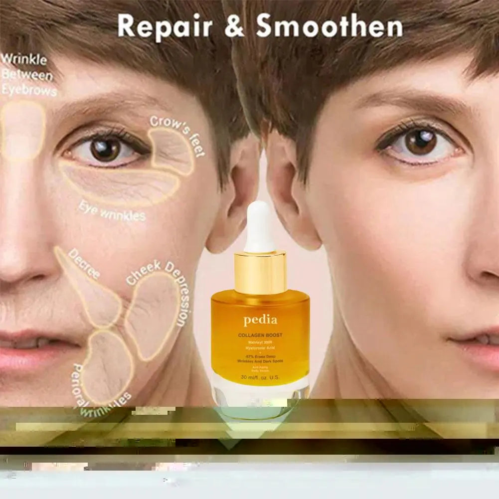 30ml Pedia Advanced Collagen Boost Anti Aging Serum Face Mosturizure Tightening Lifting Collagen Face Serum For All Skin