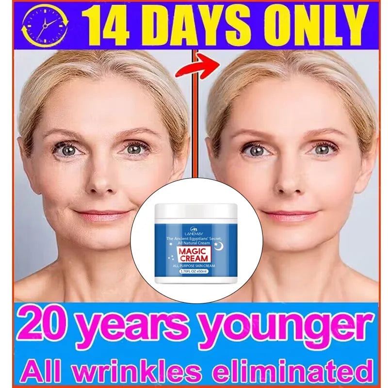 Magic Wrinkle Remover Face Cream Anti-Aging Fade Fine Lines Lifting Firming Whitening Moisturizing Beauty Skin Care Cosmetic 50g